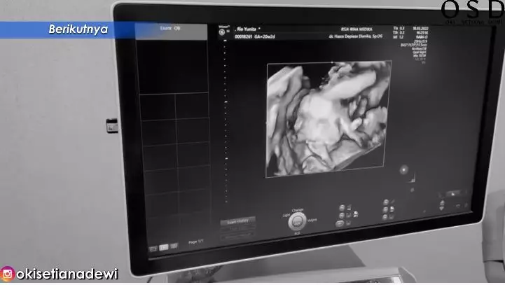 momen ria ricis cek kandungan © YouTube