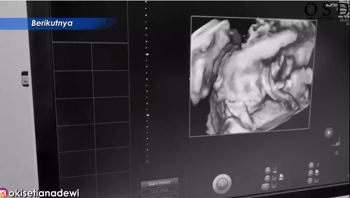 momen ria ricis cek kandungan © YouTube