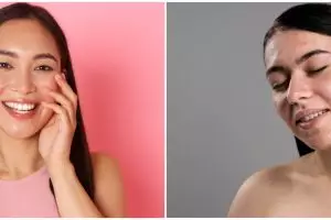 7 Manfaat Serum Implora Acne, bantu kulit bebas jerawat