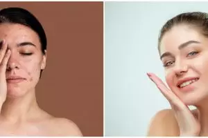 7 Manfaat serum NR Glow, bantu mengencangkan kulit