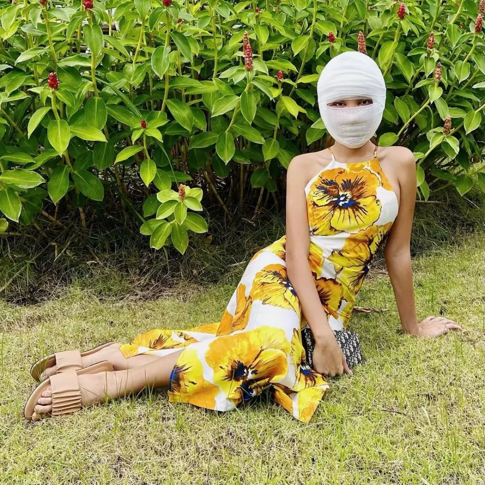 Potret kondisi Lucinta Luna usai operasi wajah © Instagram