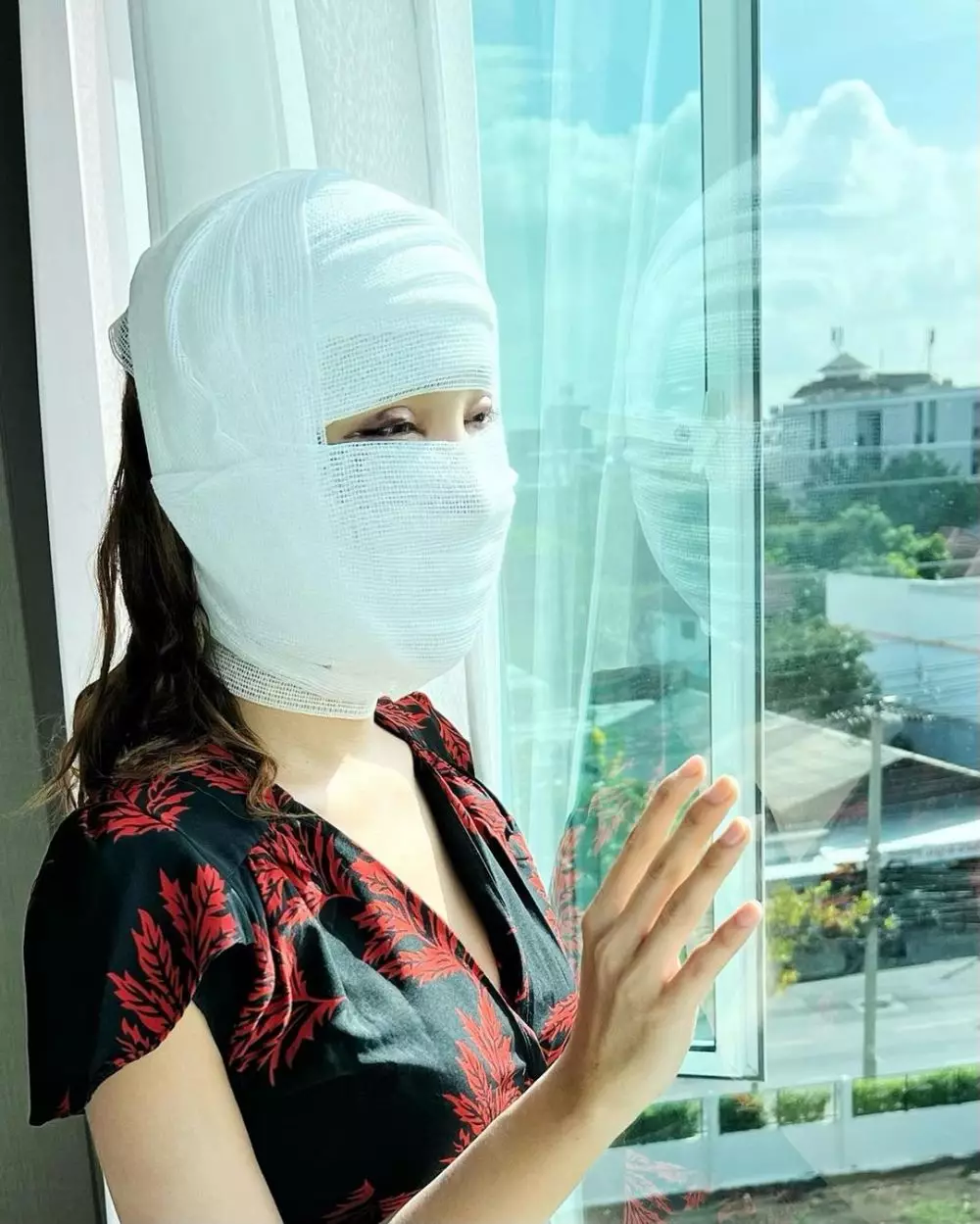 Potret kondisi Lucinta Luna usai operasi wajah © Instagram