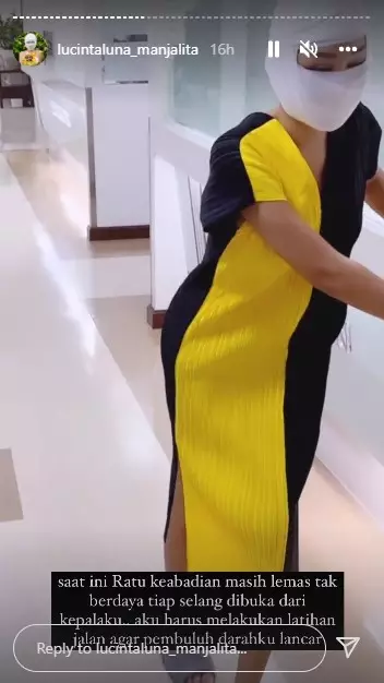 Potret kondisi Lucinta Luna usai operasi wajah © Instagram