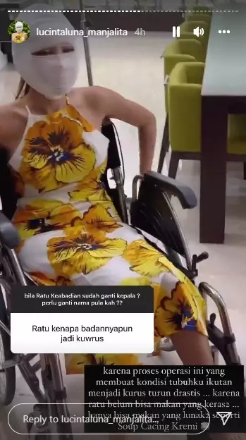 Potret kondisi Lucinta Luna usai operasi wajah © Instagram