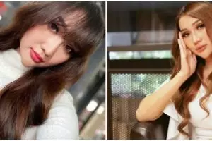 9 Potret kondisi Lucinta Luna usai operasi wajah, masih terasa nyeri