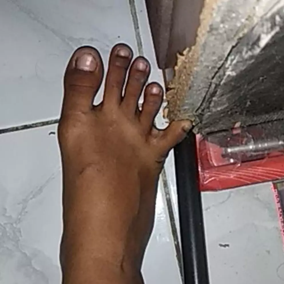 13 Momen apes sakit tak berdarah, kamu pernah mengalami?