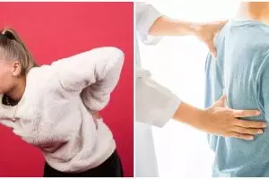 Skoliosis adalah kelainan tulang belakang, ini gejala dan penyebabnya