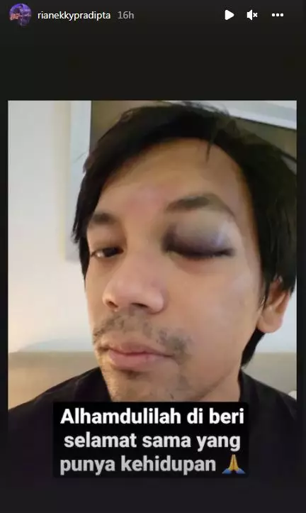 D'Masiv alami kecelakaan © berbagai sumber