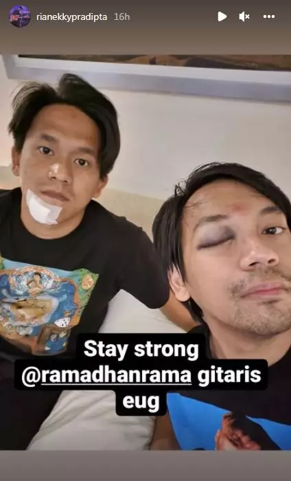 D'Masiv alami kecelakaan © berbagai sumber