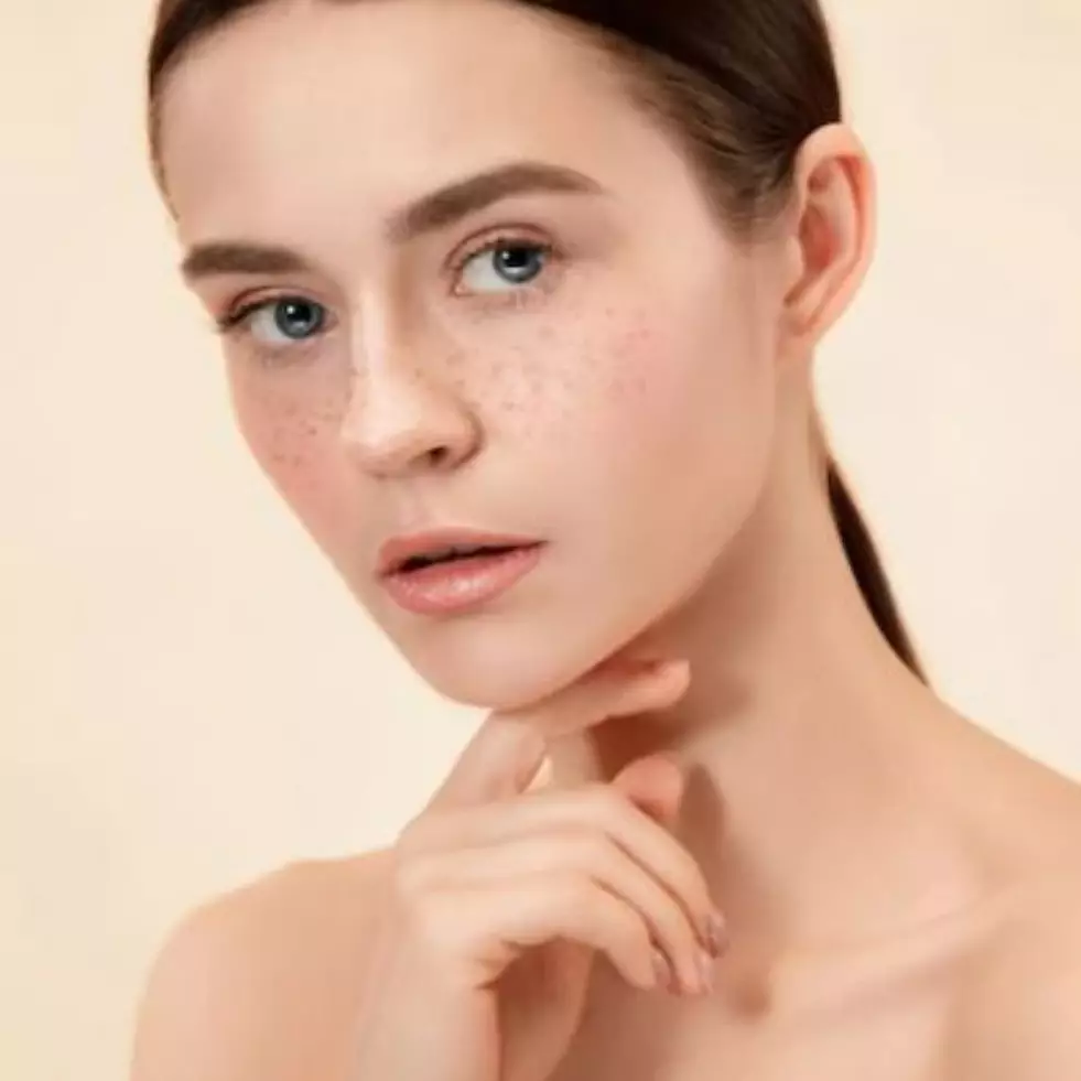 7 Serum dark spot merek lokal di bawah Rp 150 ribu, bikin wajah bersih