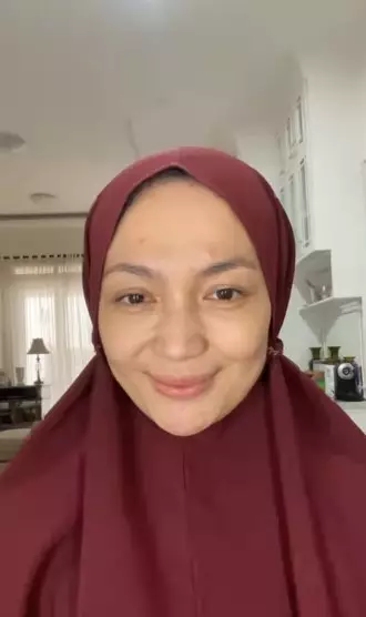 Potret Imel Putri tanpa makeup © Instagram