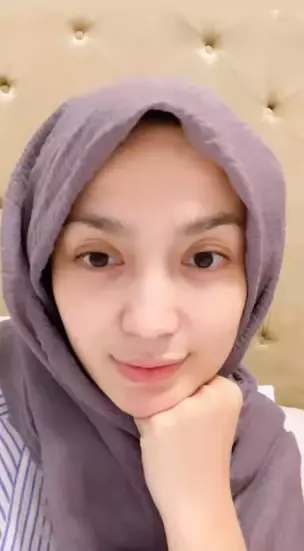 Potret Imel Putri tanpa makeup © Instagram