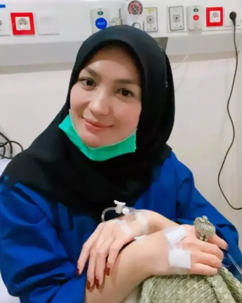 Potret Imel Putri tanpa makeup © Instagram