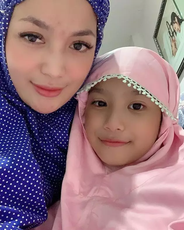 Potret Imel Putri tanpa makeup © Instagram