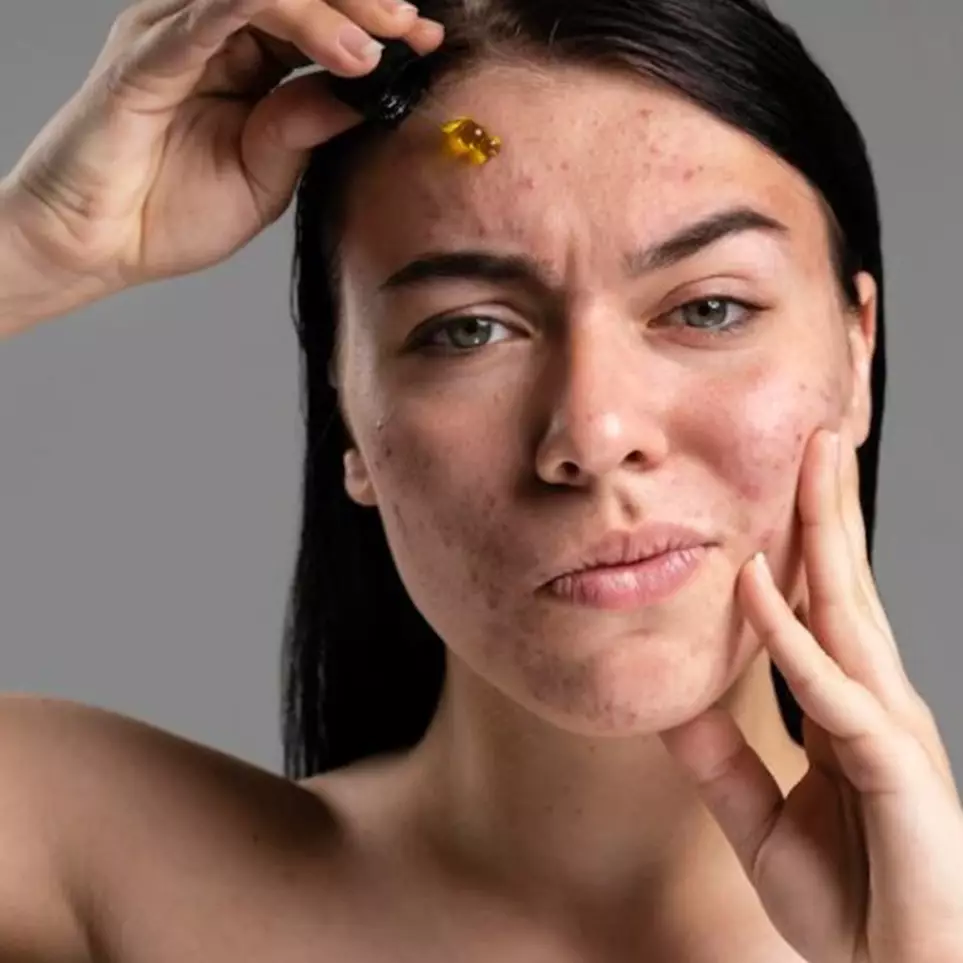 7 Skincare non-comedogenic harga di bawah Rp 150 ribu