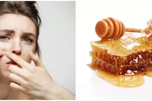 11 Cara menghilangkan bopeng di wajah, cara alami hingga teknologi