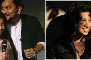 9 Potret Ayesha anak Tompi beranjak remaja, ikuti jejak sang ayah