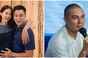 7 Potret terbaru Baim Wong tampil botak, perdana gunduli rambut