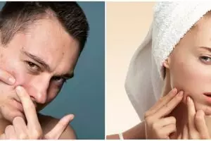 7 Rekomendasi Emina skincare, basmi jerawat membandel