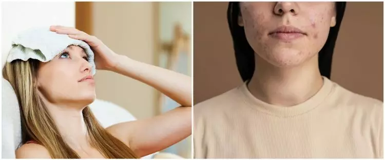 6 Cara mengatasi biduran di wajah secara alami, kompres air dingin