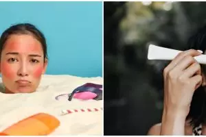 7 Manfaat tabir surya untuk wajah, mencegah kulit terbakar