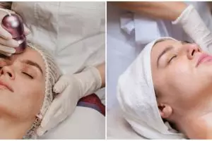 7 Tren perawatan kecantikan selama bulan Ramadhan, facial hingga botox