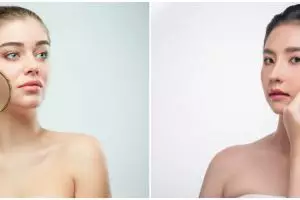 7 Manfaat Somethinc Niacinamide Moisture Beet Serum, wajah pun glowing