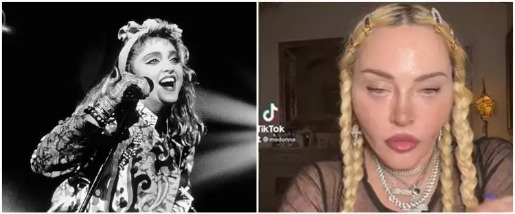 Viral potret wajah Madonna usai operasi plastik, bikin fans prihatin