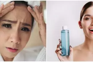 11 Penyebab kulit kusam dan cara mengatasinya