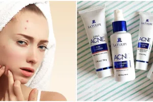 6 Skincare La Tulipe untuk wajah berjerawat, bikin kulit lebih halus