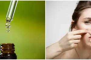 9 Manfaat tamanu oil untuk wajah, hempaskan flek hitam