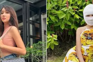 Buka perban live, 7 potret wajah baru Lucinta Luna usai operasi kepala