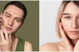 11 Skincare lokal yang bagus untuk menghilangkan bekas jerawat