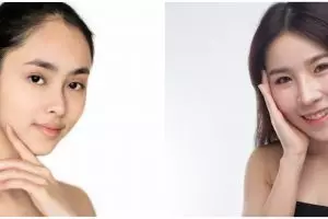 10 Manfaat uap air panas untuk wajah, bantu bersihkan pori-pori