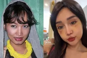 Jalani operasi plastik di Korea, ini 9 potret dulu & kini Lucinta Luna