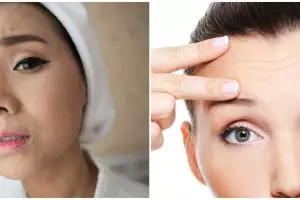 5 Masalah kulit selama bulan puasa dan cara mengatasinya