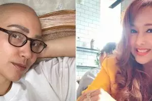 Kisah 11 seleb berjuang lawan kanker, jalani operasi hingga kemoterapi