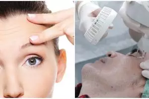 9 Cara menghilangkan garis halus di wajah, cara alami hingga teknologi