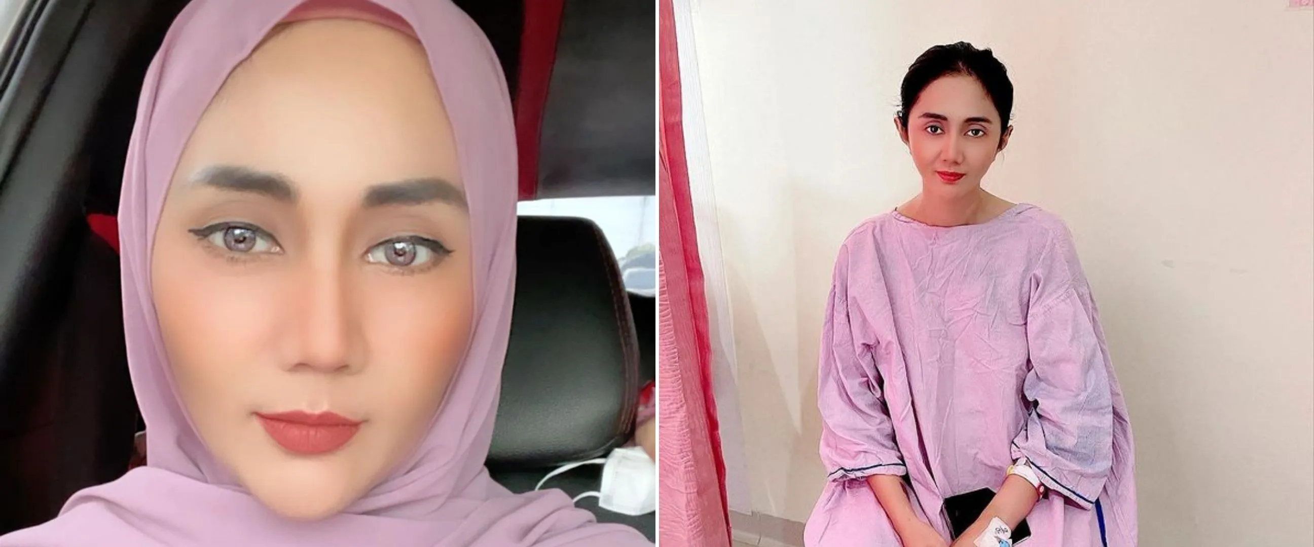 7 Kisah Aida Saskia lawan kanker payudara, jalani empat kali operasi