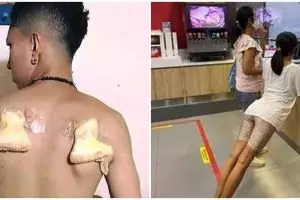 11 Potret nyeleneh orang saat difoto dari belakang ini ada-ada aja