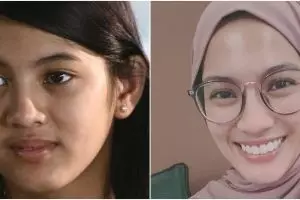 11 Potret dulu dan kini Alyssa Soebandono, disebut kian kurus