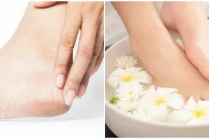 11 Cara mengatasi tumit kaki pecah-pecah secara alami, mudah dilakukan