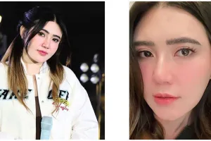 6 Perawatan wajah Via Vallen, pakai infus kromosom