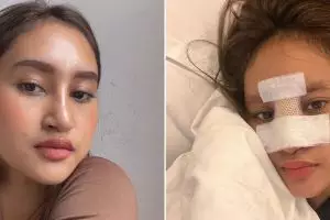 11 Potret kondisi Permesta Dhyaz usai angkat implan, alami sulit napas