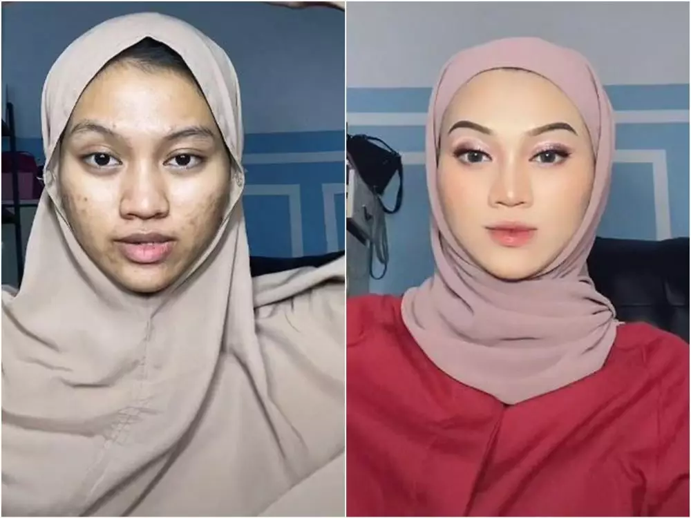 transformasi wanita berjerawat setelah makeup © TikTok