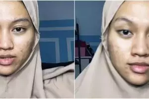 Potret transformasi wanita berjerawat setelah dimakeup, bikin pangling