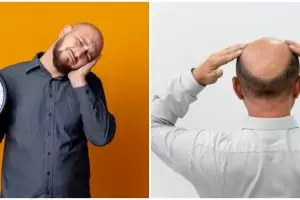 7 Arti mimpi kepala botak, simbol kebaikan dan keburukan