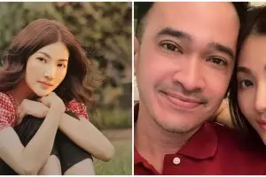 Sarwendah idap penyakit langka di batang otak, Ruben Onsu tetap tegar