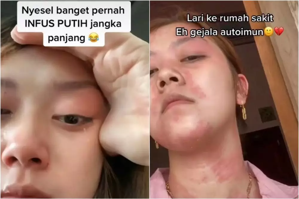 wanita infus putih berujung autoimun © TikTok