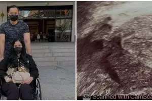 Alami keguguran, Annisa Pohan: Tidak ada kata putus asa